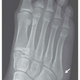 Image for article titled From Wiiitis to Wii Fractures: A Guide to Nintendoid Medical Conditions